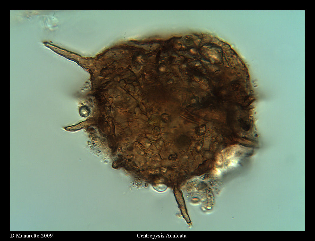 Centropyxis Aculeata